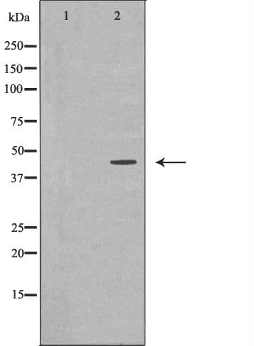 NDRG1 Antibody