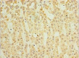 Polyclonal Rabbit anti-Human SGSH Antibody (aa273-502, IHC)