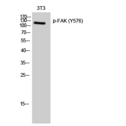FAK / Focal Adhesion Kinase Antibody (520-600 aa)