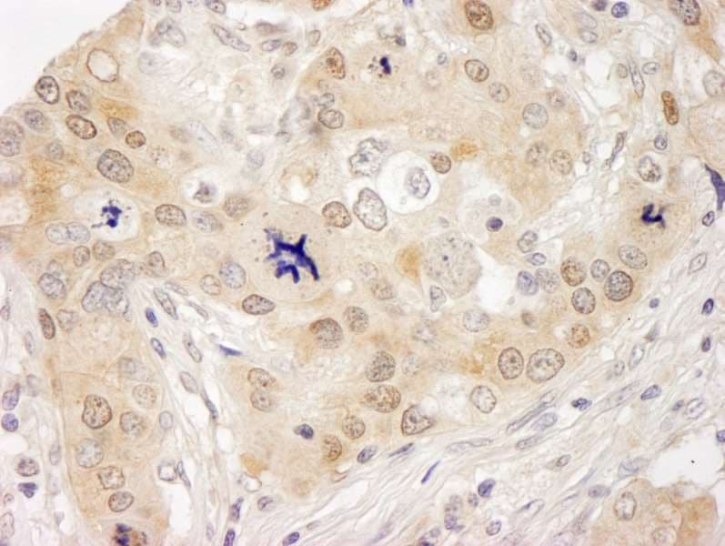HUWE1 / ARFBP1 Antibody (aa2250-2300)