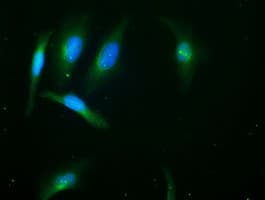 PNMT Antibody (clone OTI2E3)