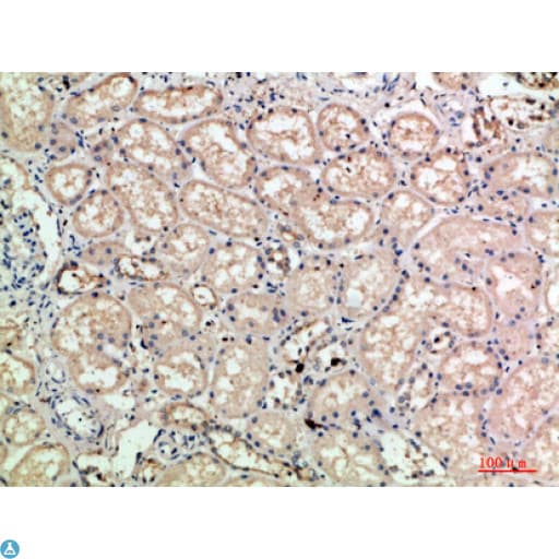 SELE / CD62E / E-selectin Antibody
