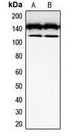 c-Kit / CD117 Antibody (Internal)