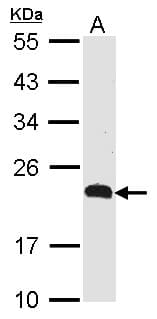Polyclonal Rabbit anti-Human CKLFSF5 / CMTM5 Antibody (aa1-45, WB)