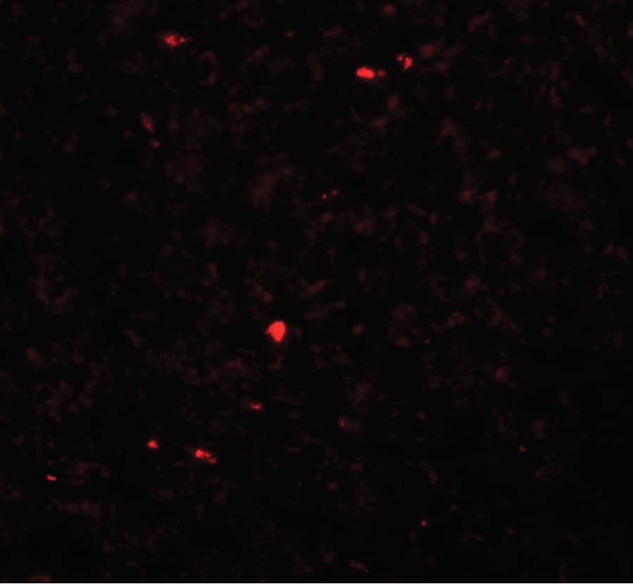 MEOX1 Antibody