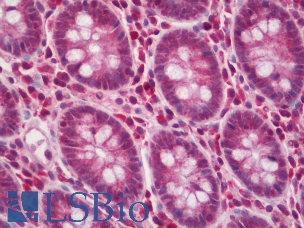 IHC-plus™ Polyclonal Rabbit anti-Human SACM1L / SAC1 Antibody (aa408-436, IHC, WB)