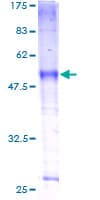 Human SLC39A9 Protein (Recombinant GST)