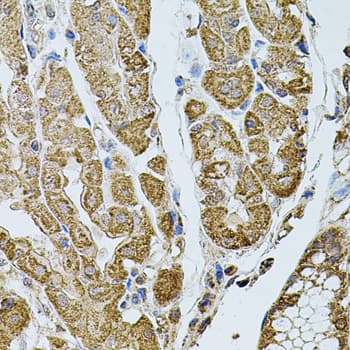 Polyclonal Rabbit anti-Human CHRFAM7A Antibody (IHC, WB)