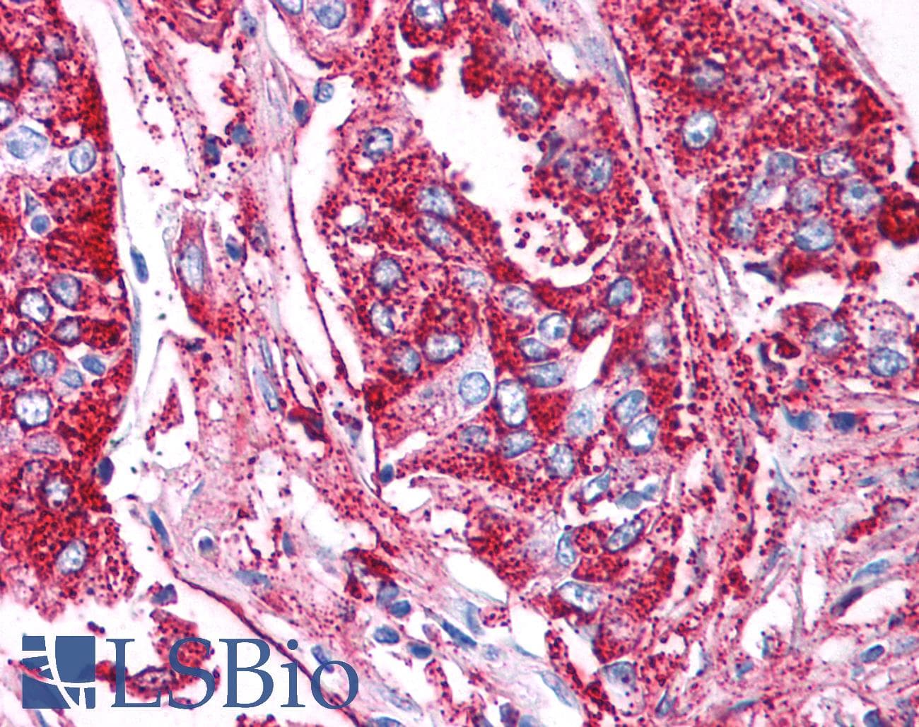 IHC-plus™ Polyclonal Rabbit anti-Human BACE1 / BACE Antibody (N-Terminus, IHC)