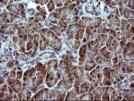 SERPINB3 Antibody (clone OTI1G5)