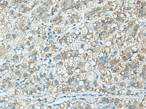 C3AR / C3a Receptor Antibody