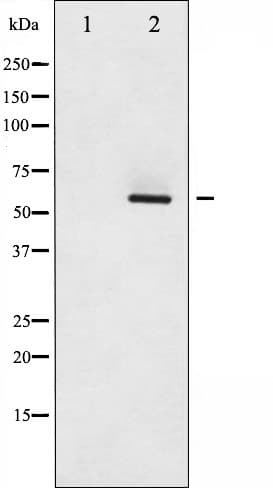 Polyclonal Rabbit anti-Human SRC Antibody (phospho-Ser75, IHC, IF, WB)