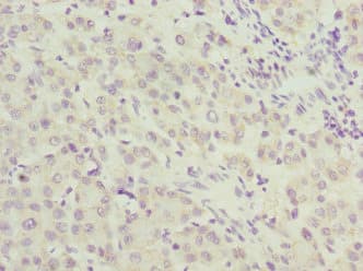 HUPF2 / UPF2 Antibody