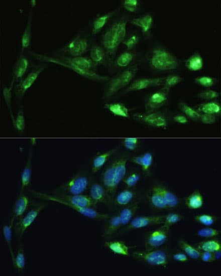 Vimentin Antibody