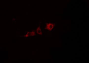 Polyclonal Rabbit anti-Human CYP2J2 Antibody (IHC, IF, WB)