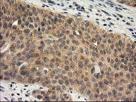 RASSF1 / RASSF1A Antibody (clone OTI2B11)