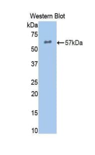 MPO / Myeloperoxidase Antibody (aa253-718)