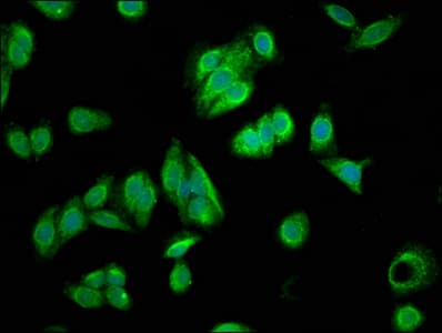FILIP1L Antibody