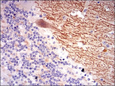 GABBR2 / GABA B Receptor 2 Antibody (aa319-483, clone 5G7F7)