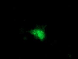 SMS / Spermine Synthase Antibody (clone OTI2G8)