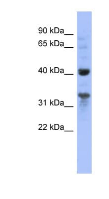 MRPL37 Antibody (aa35-84)