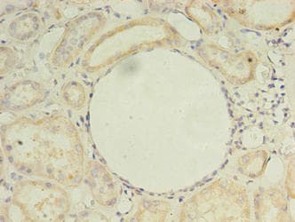 Polyclonal Rabbit anti-Human ZDHHC4 Antibody (IHC, WB)