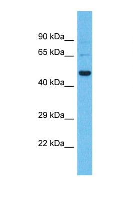 Polyclonal Rabbit anti-Human SHISA9 Antibody (aa163-212, WB)