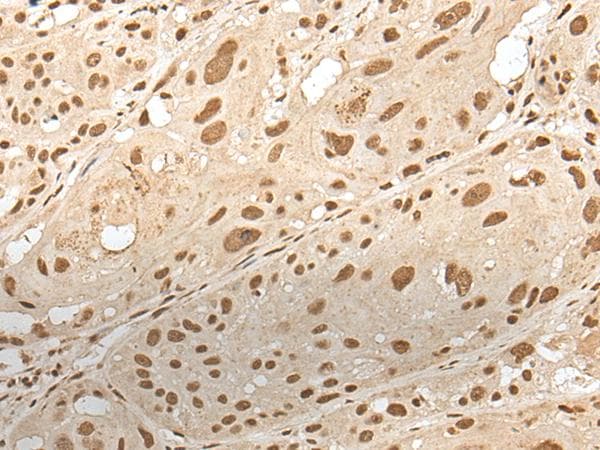 ZNF274 Antibody