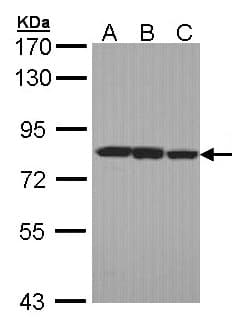IHC-plus™ LOXL2 Antibody (aa454-742)