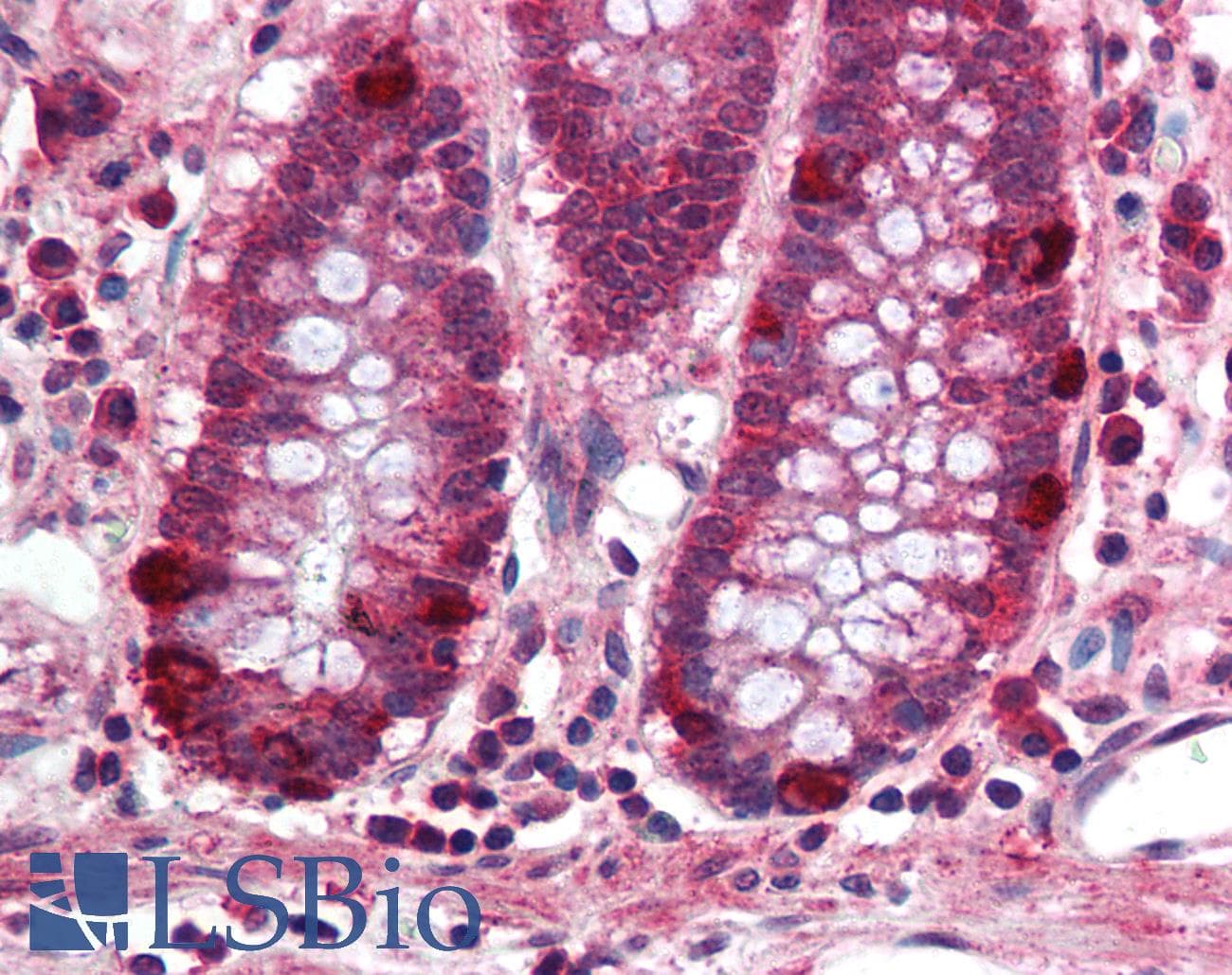 IHC-plus™ PRDM5 Antibody (aa100-200)
