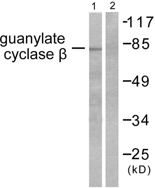 GUCY1B3 Antibody