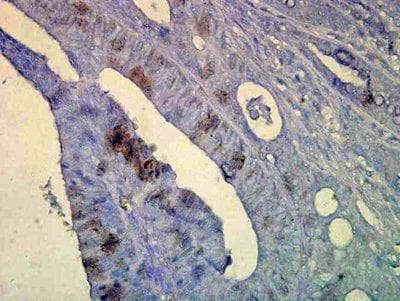 Heat Shock Protein 70 / HSPA1A Antibody (aa436-503, clone C92F3A-5)