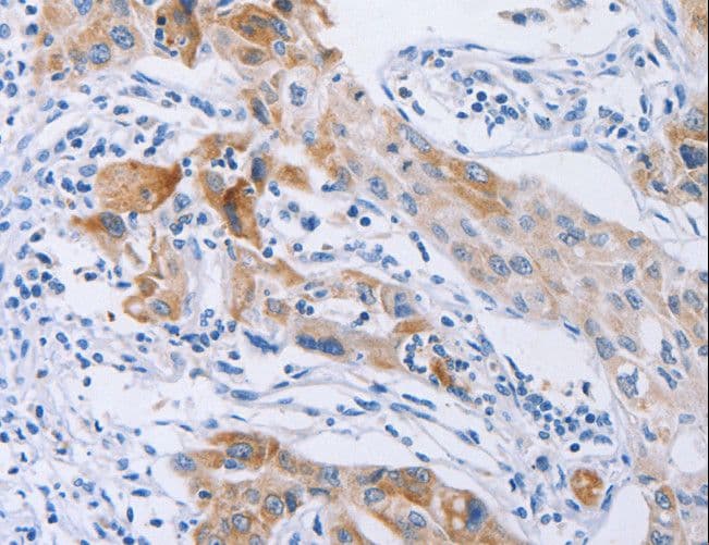 Polyclonal Rabbit anti-Human CDC27 Antibody (IHC, WB)