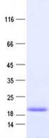 Human TNNC1 / Cardiac Troponin C Protein (Recombinant DDK,C-terminus)