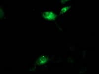 IHC-plus™ AQP1 / Aquaporin 1 Antibody (clone OTI2D10)