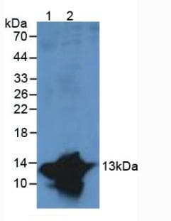 S100A9 / MRP14 Antibody (aa1-114, APC)