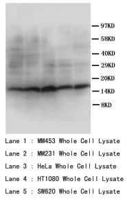 PathPlus™ SST / Somatostatin Antibody (aa1-14)