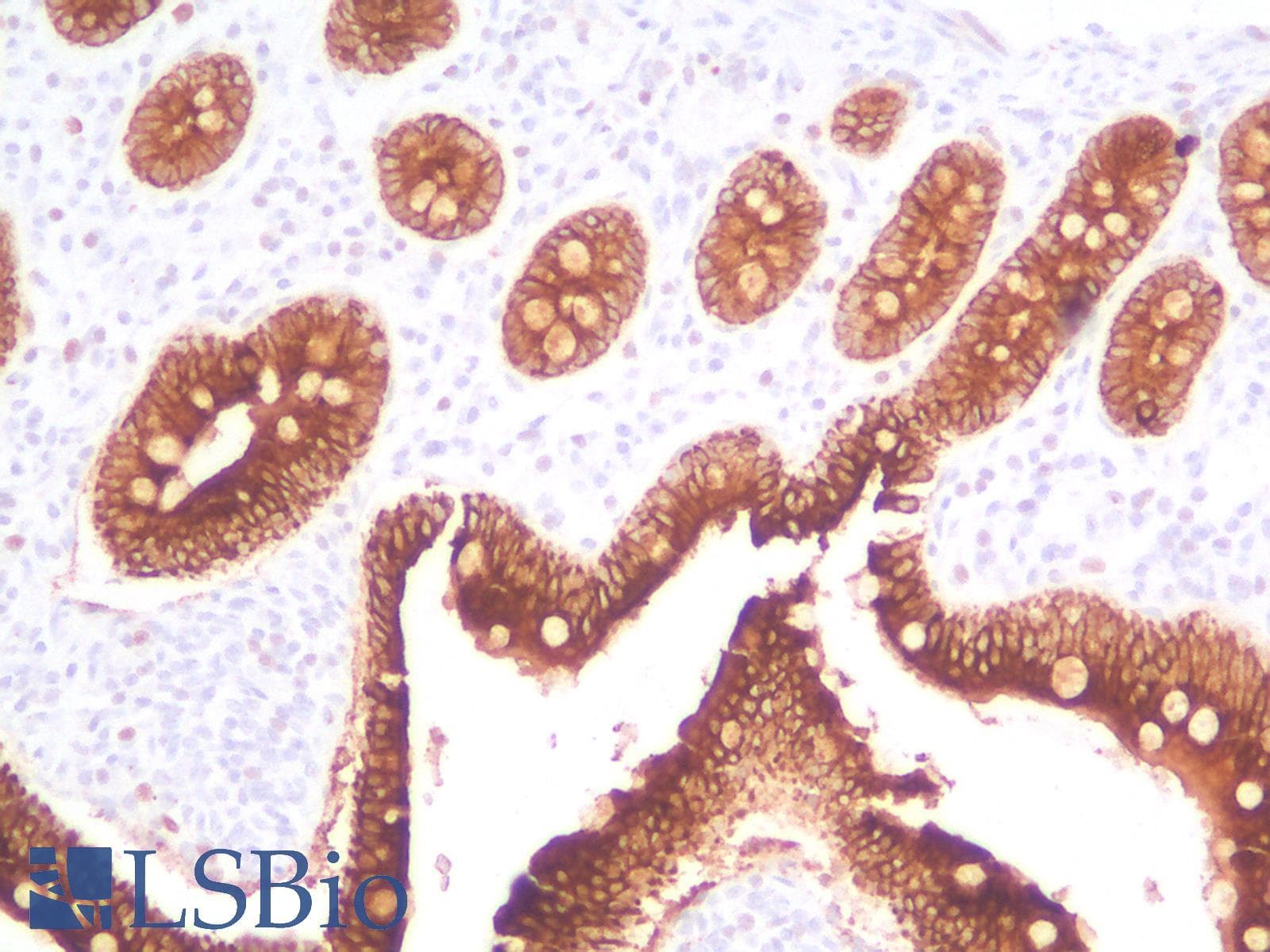 PathPlus™ KRT19 / CK19 / Cytokeratin 19 Antibody (Concentrated)