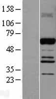 ABI2B / ABI2 Protein (Over-Expression Lysate Myc-DDK (Flag))