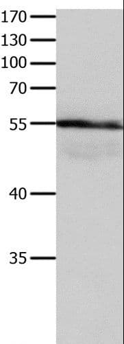 HP / Haptoglobin Antibody