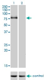 CDH6 / K Cadherin Antibody (clone 2F2)