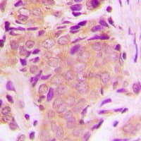 MAP3K7 / TAK1 Antibody (phospho-Thr184)