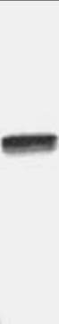 RELA / NFKB p65 Antibody (C-Terminus)