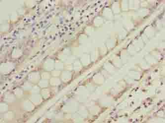 NSUN7 Antibody