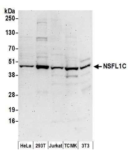 Polyclonal Rabbit anti-Human NSFL1C Antibody (aa25-75, WB)