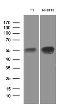 LHX2 Antibody (aa220-406, clone OTI2E8)