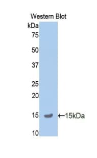 APP / Beta Amyloid Precursor Antibody (aa672-770)