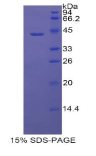 Rat LCN6 Protein (Recombinant His-GST)