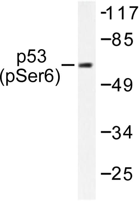 Polyclonal Rabbit anti-Human TP53 / p53 Antibody (phospho-Ser6, IHC, WB)