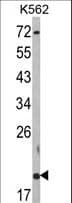 Polyclonal Rabbit anti-Human RMA1 / RNF5 Antibody (aa1-30, WB)